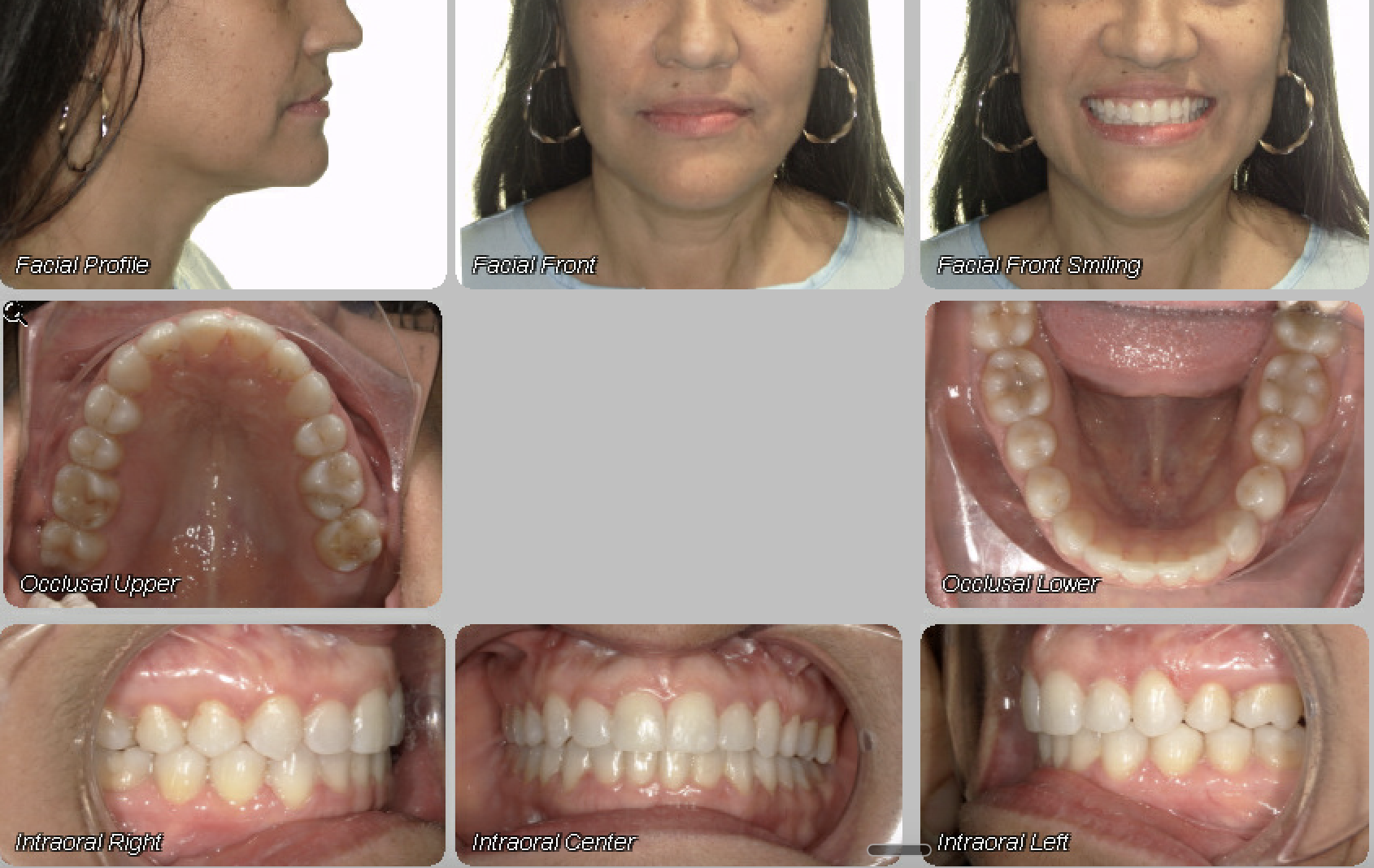 Case 07 — after treatment
