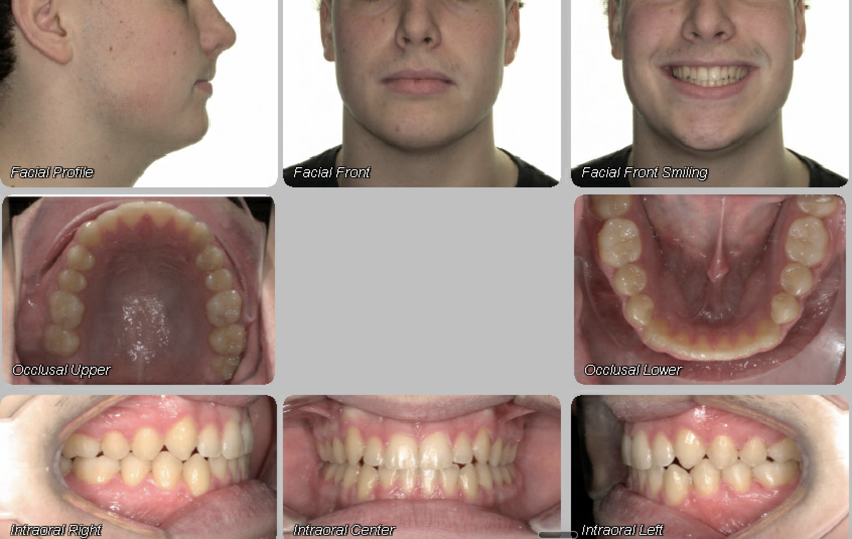 Case 08 — after treatment
