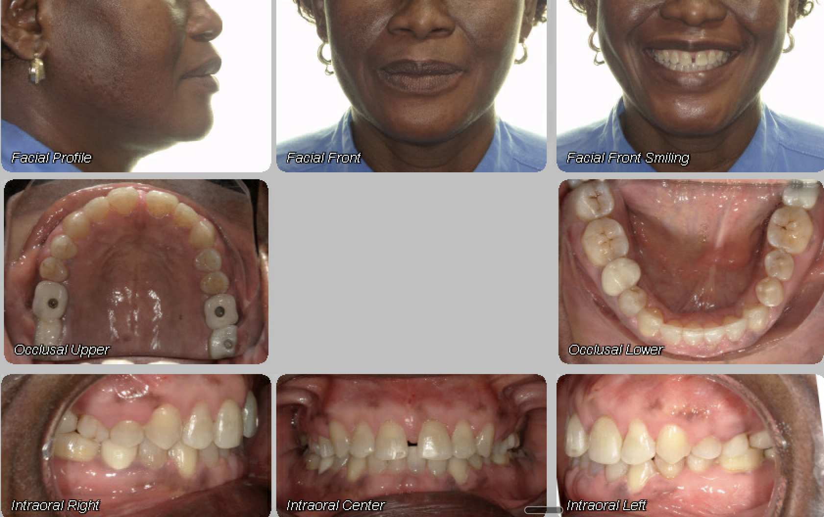 Case 09 — after treatment