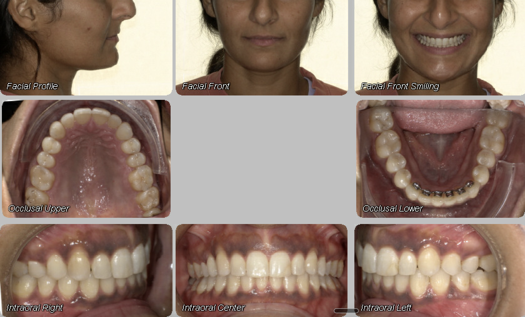 Case 10 — after treatment