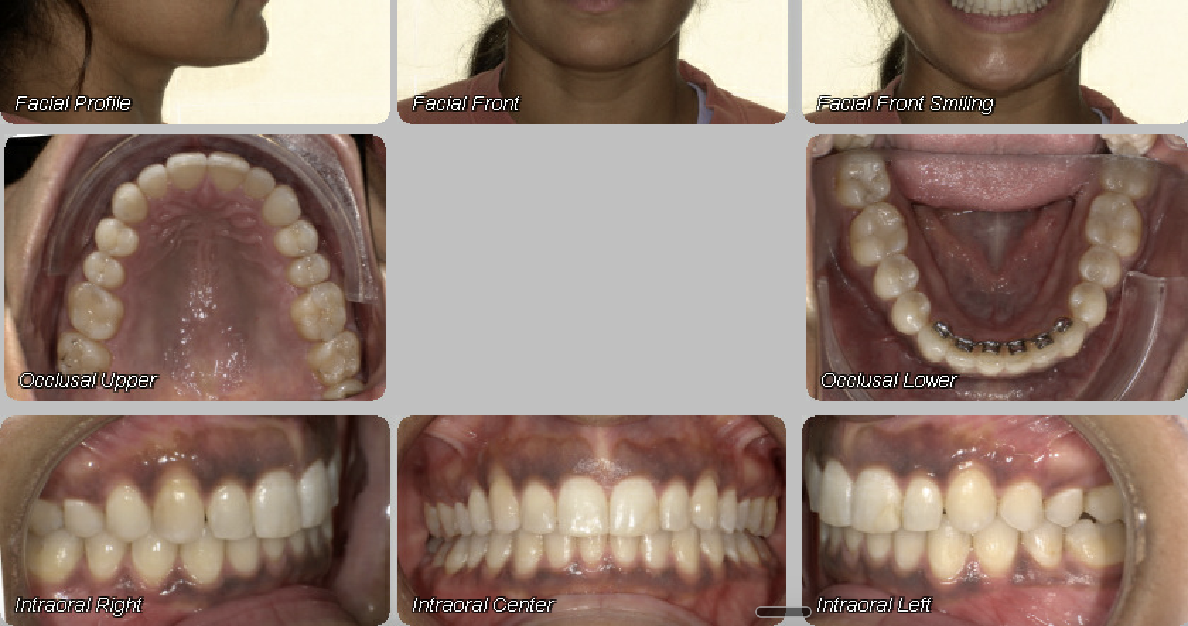Case 10 — after treatment