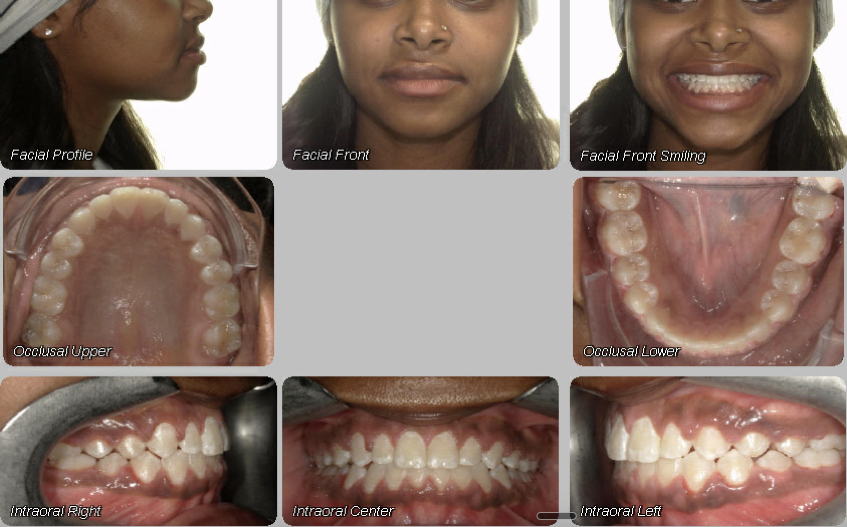 Case 12 — after treatment