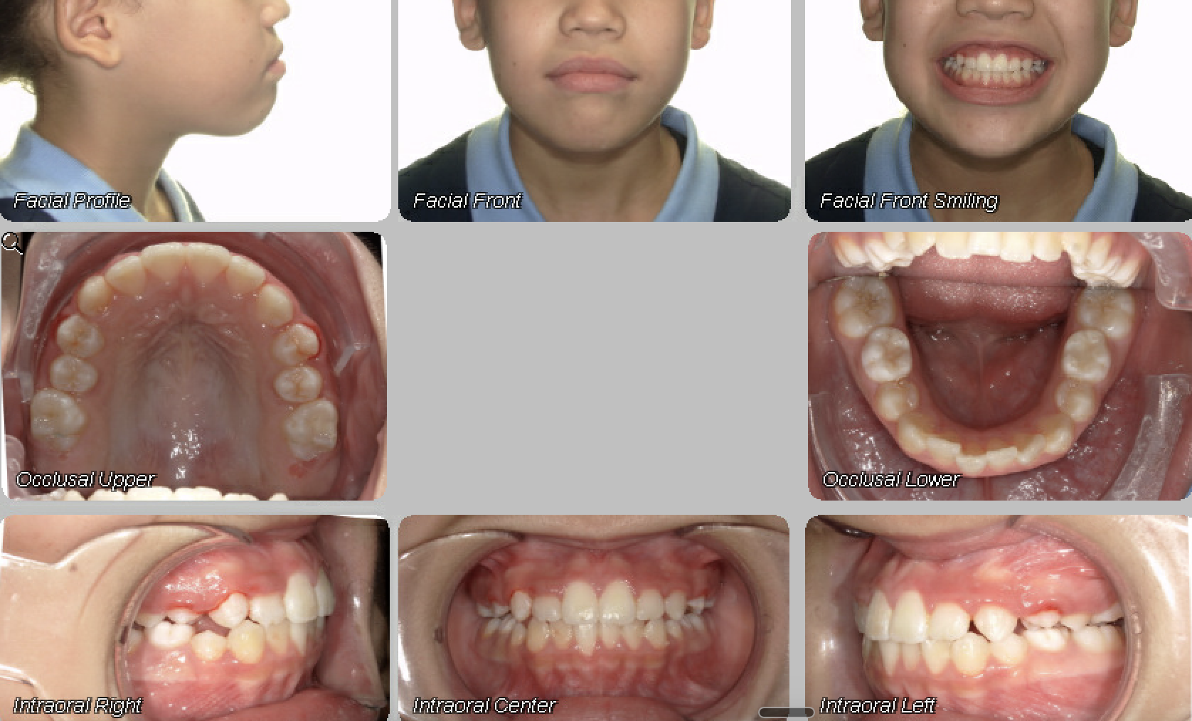 Case 01 — after treatment