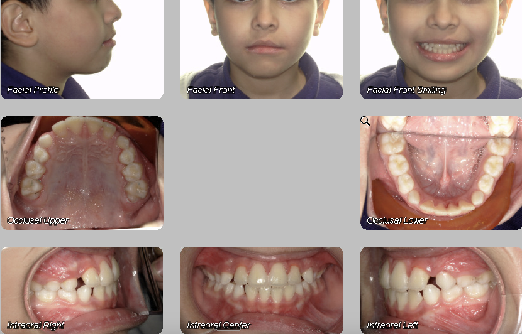Case 02 — after treatment