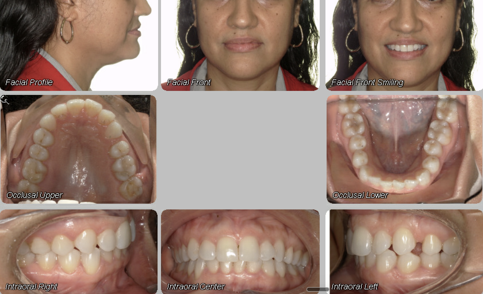 Case 07 — before treatment