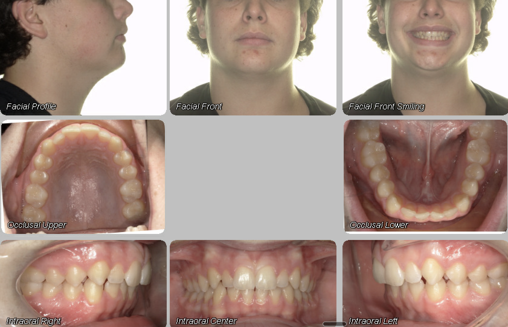 Case 08 — before treatment