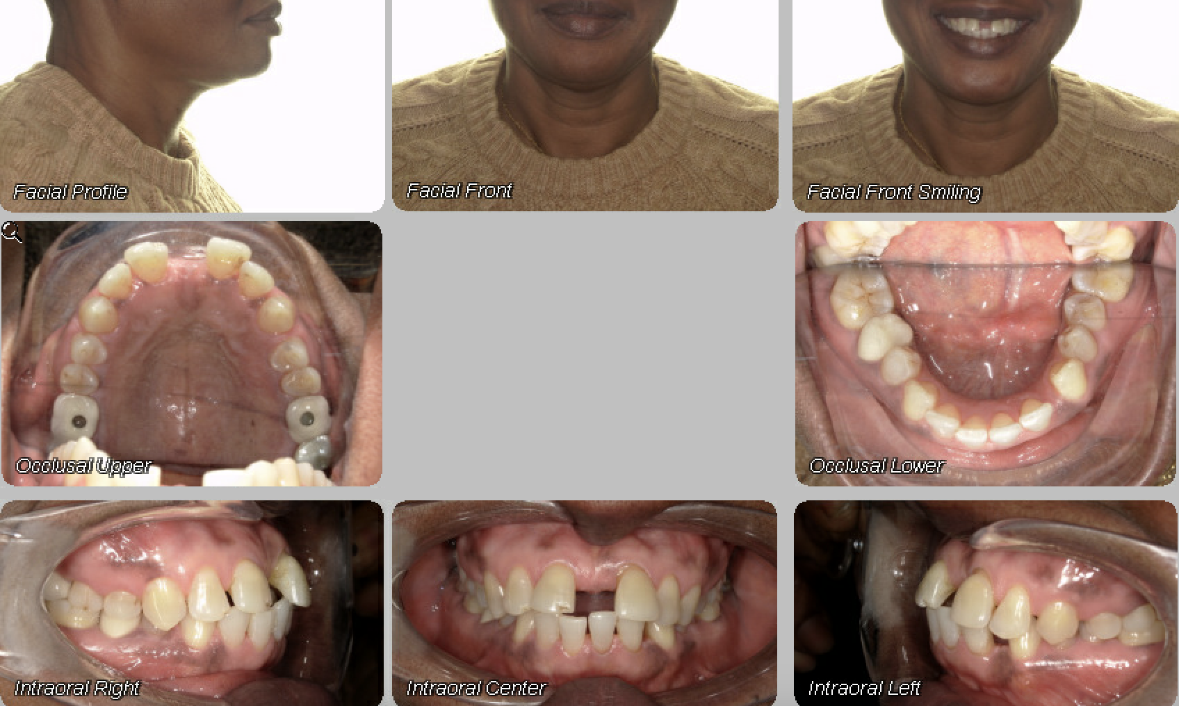 Case 09 — before treatment