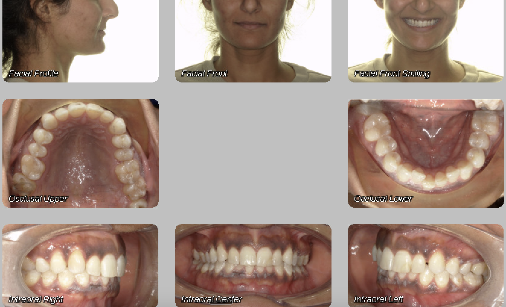 Case 10 — before treatment