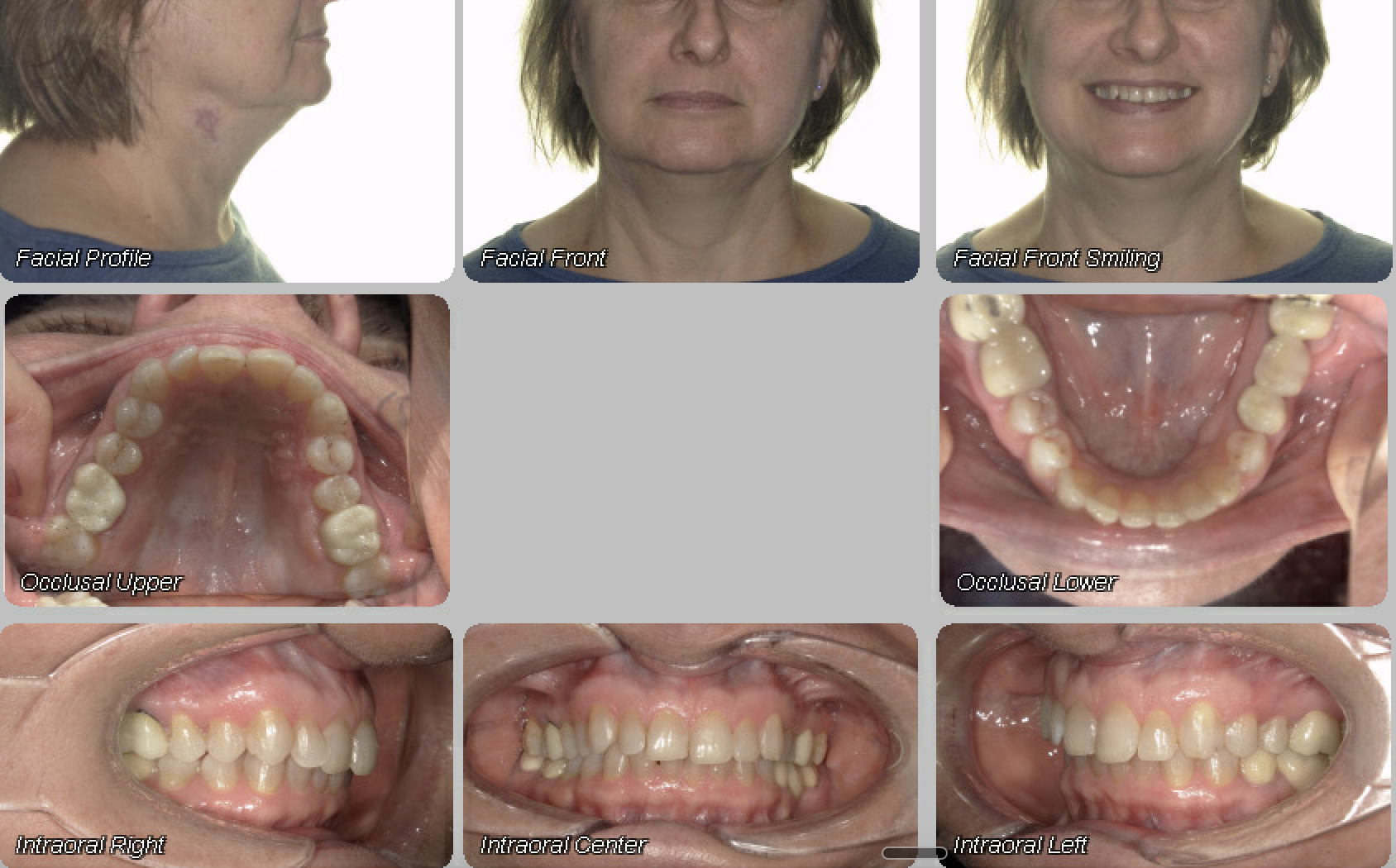 Case 11 — before treatment