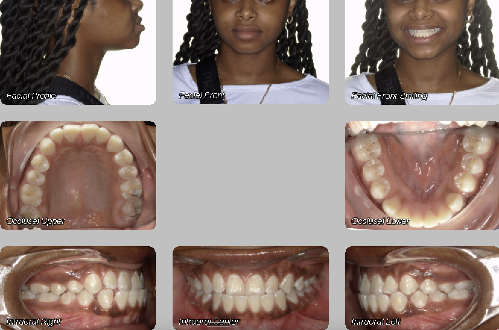 Case 12 — before treatment