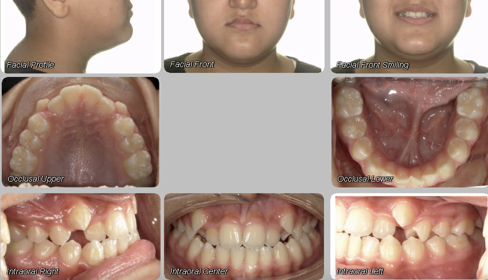Case 03 — before treatment