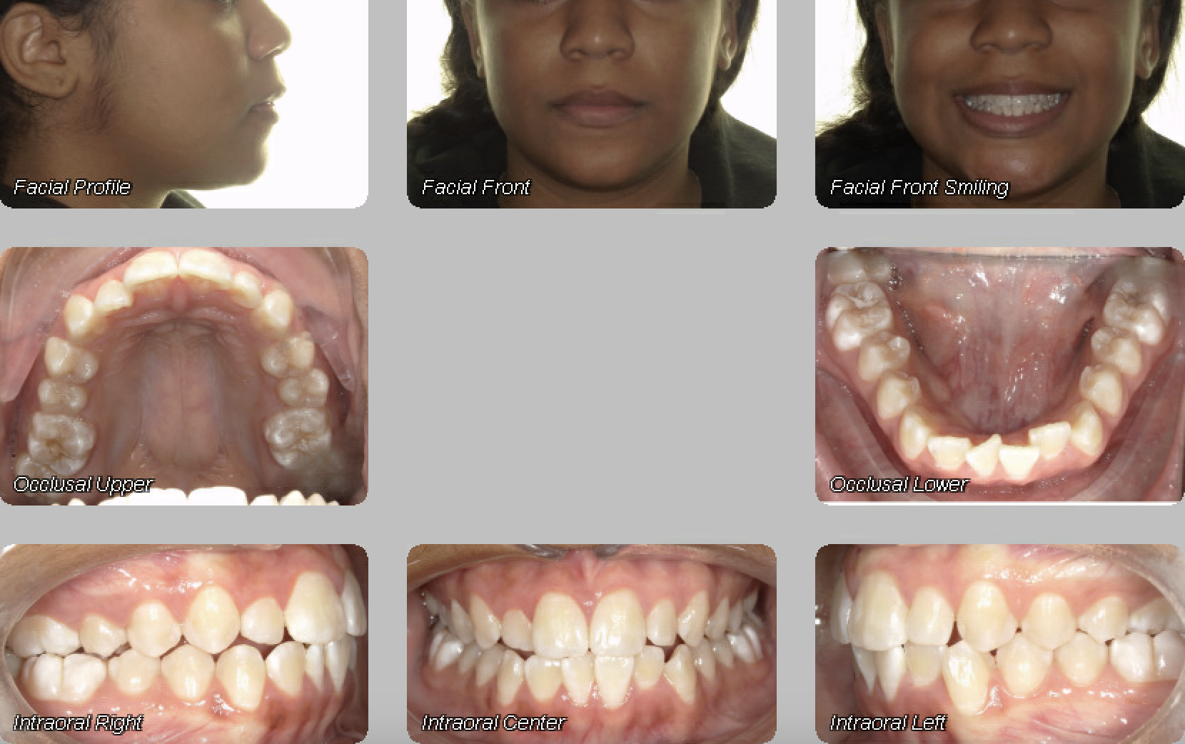 Case 04 — before treatment