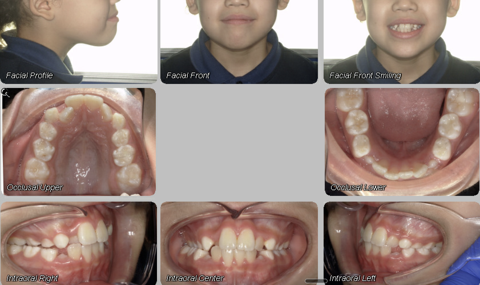 Case 01 — before treatment