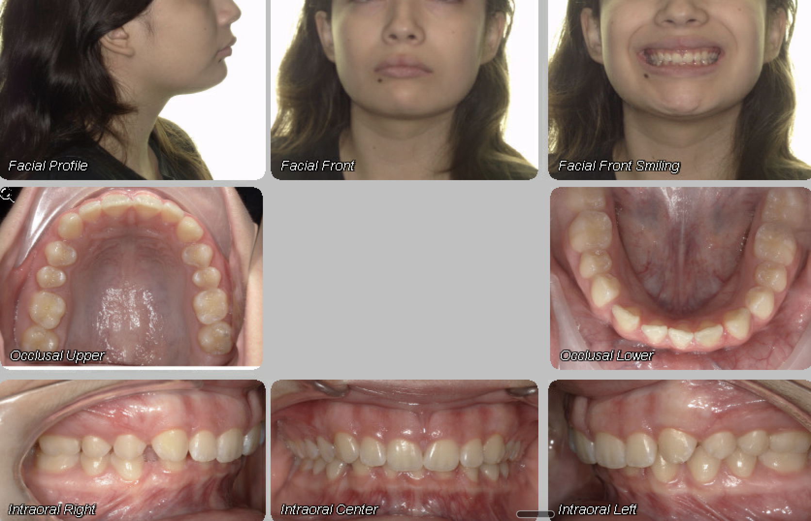 Case 05 — before treatment