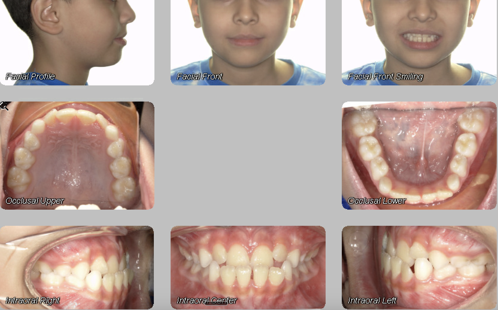 Case 02 — before treatment