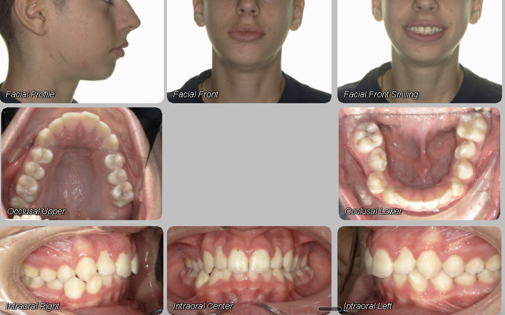 Case 06 — before treatment