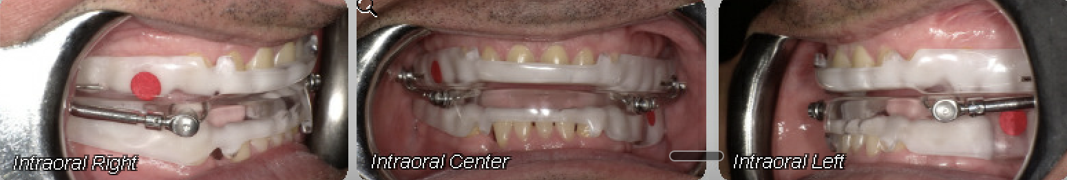 Case 14 — before treatment