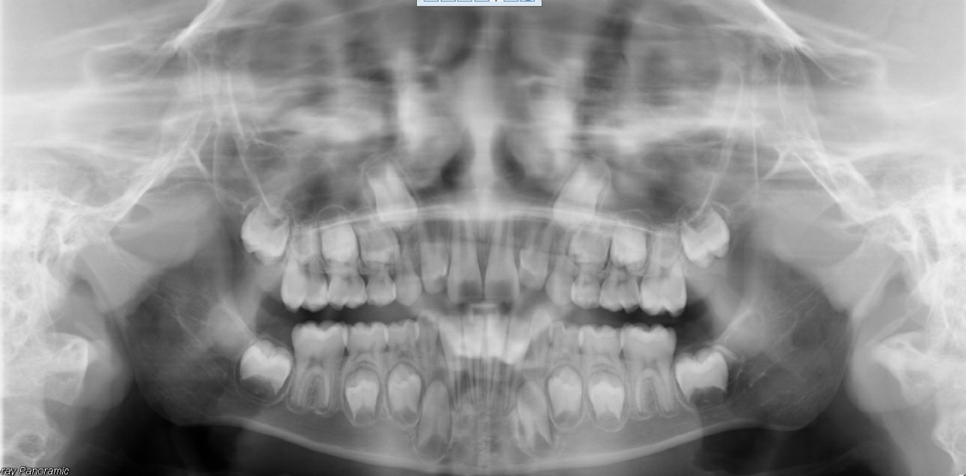Case 02 — Panoramic — before